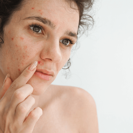5 Nutrients the Pill Depletes-and Your Skin Needs