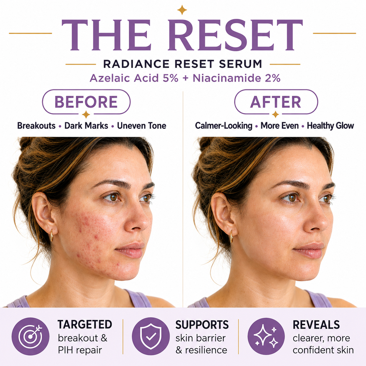 Radiance Reset